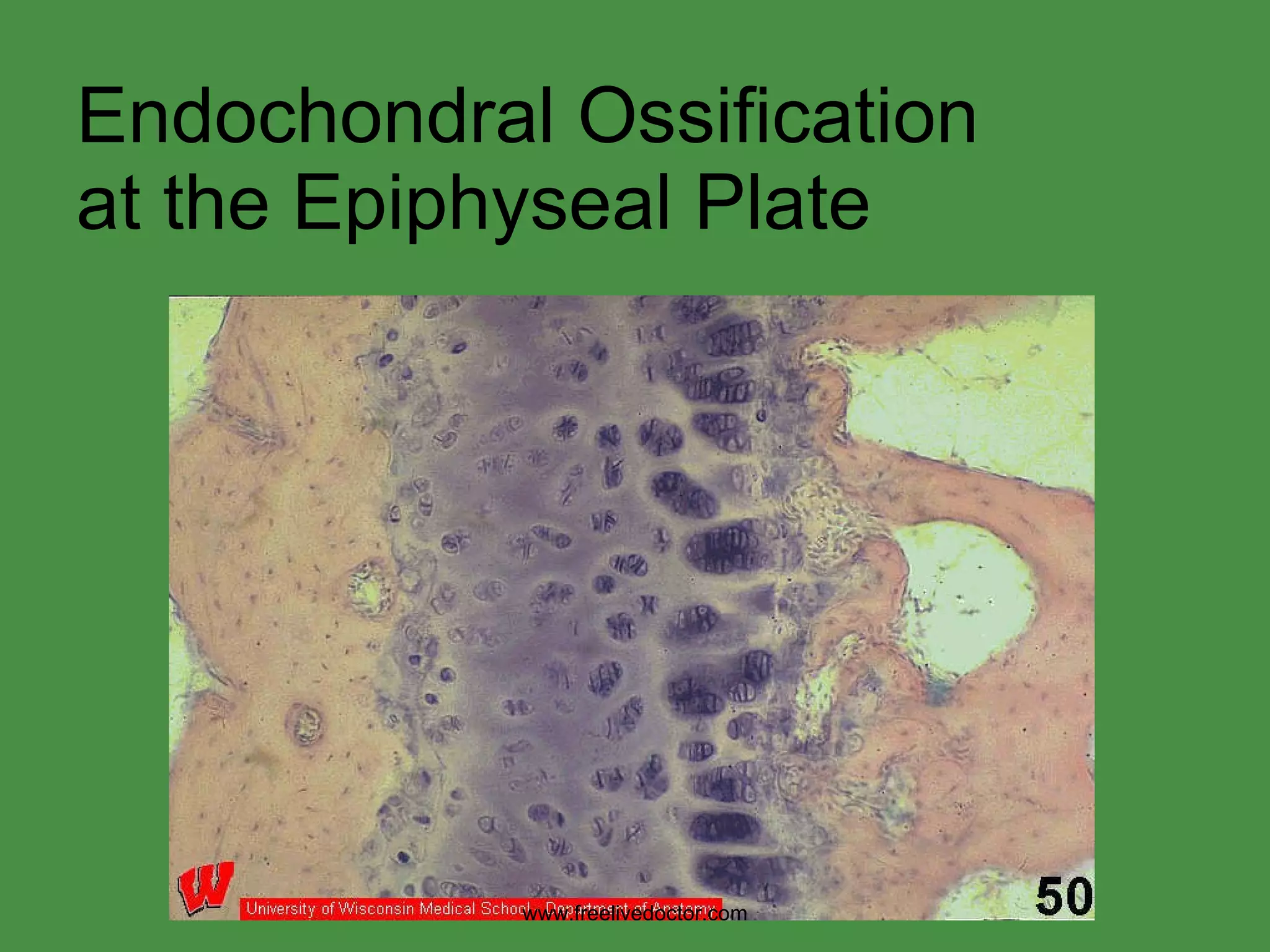 Endochondral Ossification at the Epiphyseal Plate www.freelivedoctor.com 