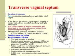 Transverse vaginal septum <ul><li>Complete or perforated </li></ul><ul><li>Rare  occurs at the junction of upper and middl...