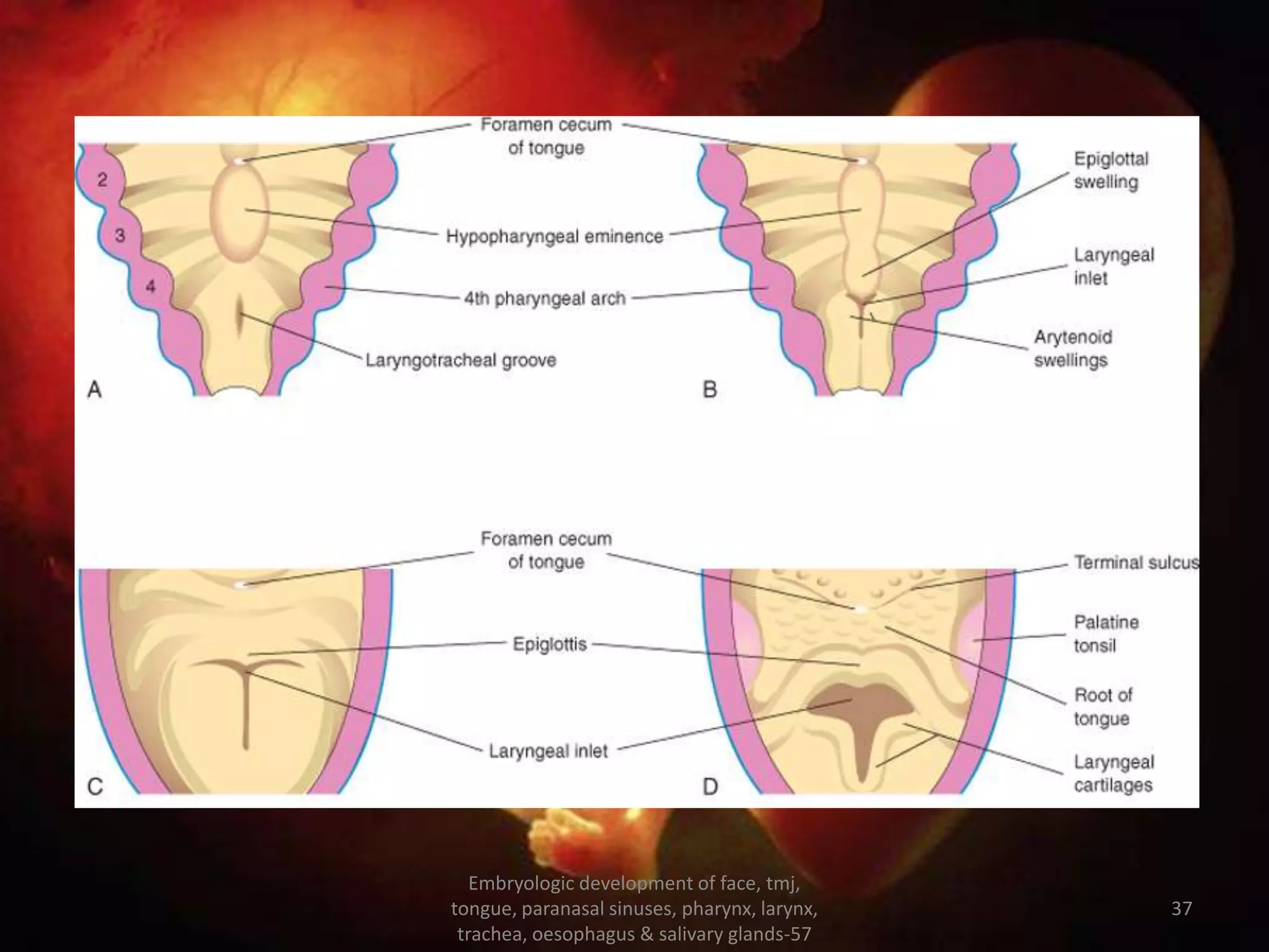 Tmj Development Embryology of face, tmj, tongue, paranasal sinuses, pharynx, larynx ...