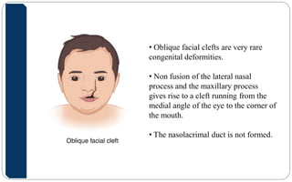 Embryology In Orthodontics | PDF