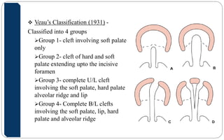 Veau Classfication Embryology In Orthodontics | PDF
