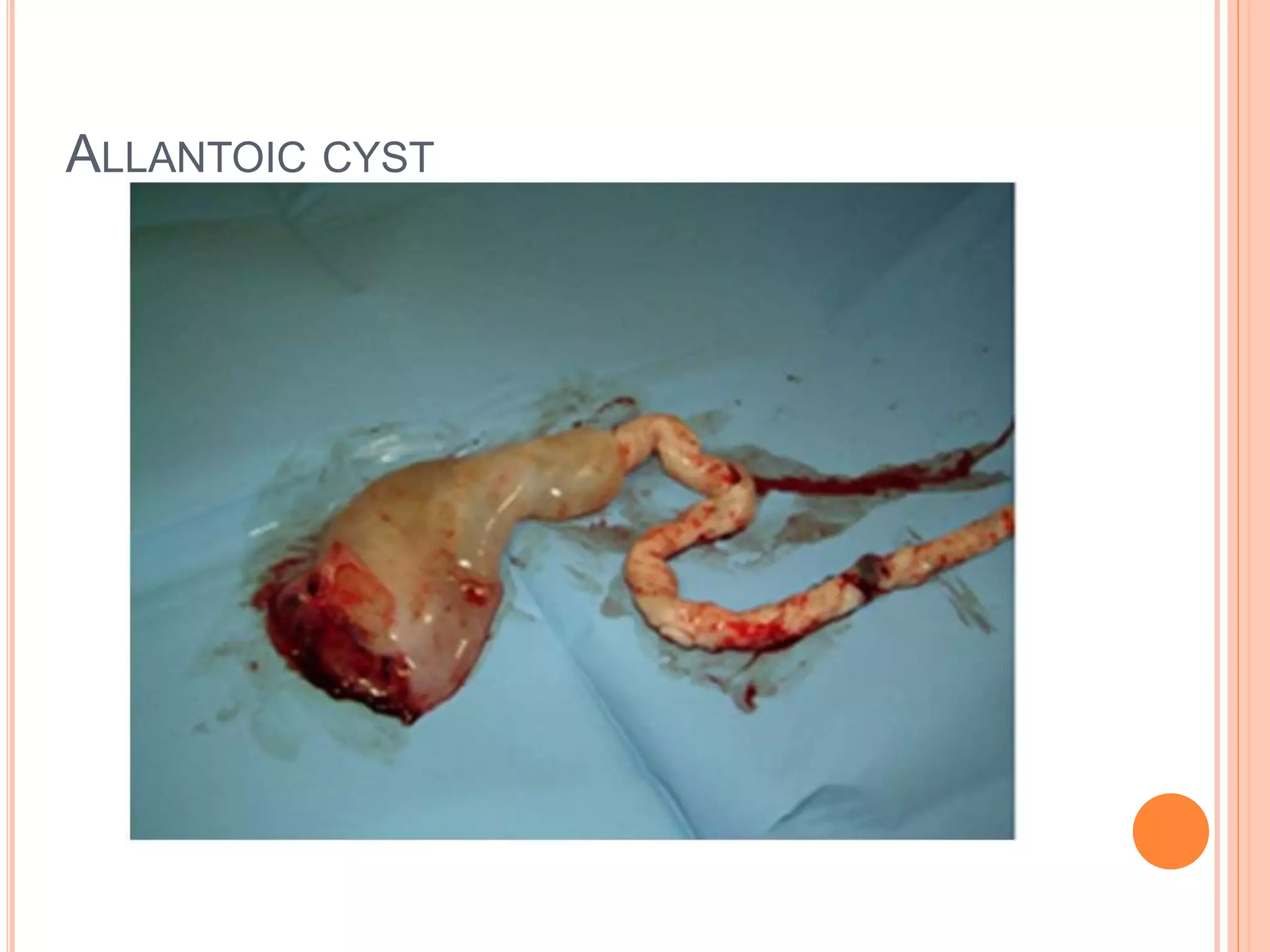 ALLANTOIC CYST
 