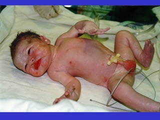 embryology -2017.ppt f or Basic Bsc nursing students