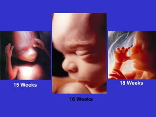 15 Weeks
16 Weeks
18 Weeks
 