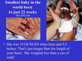 Smallest baby in the
world born
At just 22 weeks
• She was 10 OUNCES when born and 9.5
inches. That's just longer than the length of
your hand. She weighed less than a can of
soda!
Her little feet
 