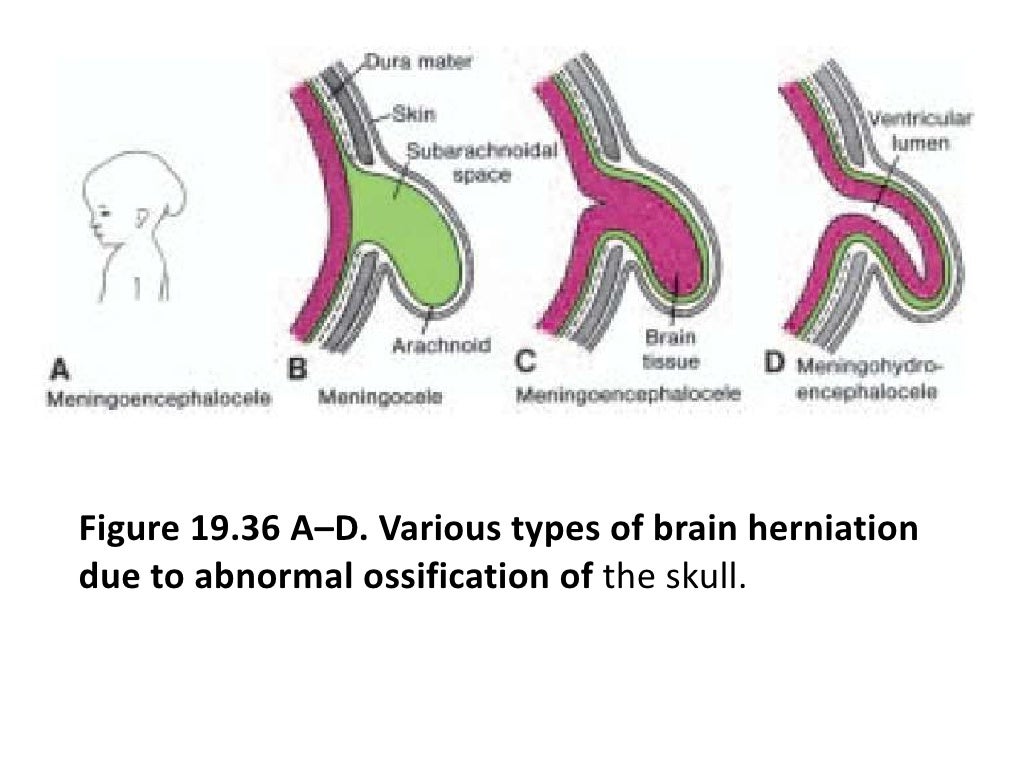 Embryology Development Of Central Nervous System