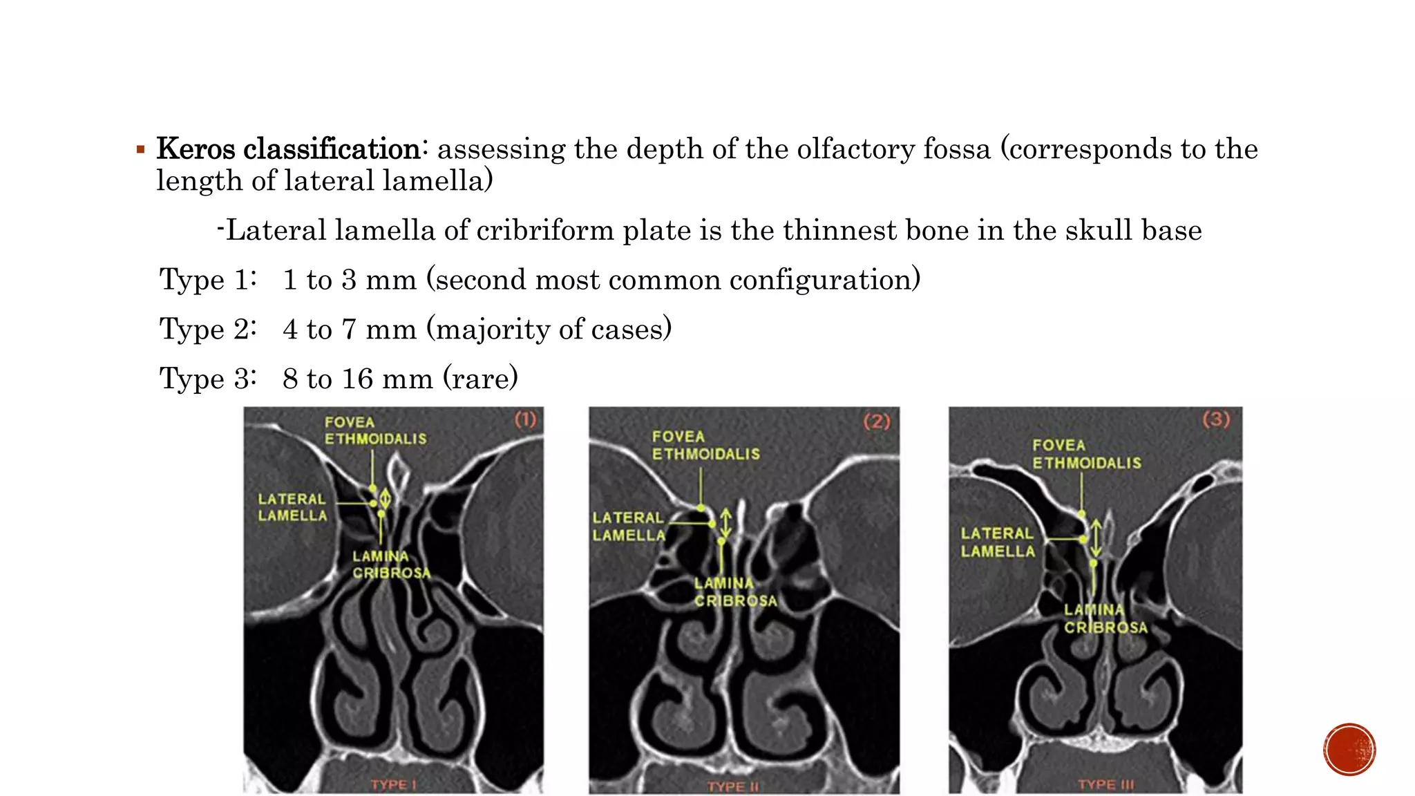 EMBRYOLOGY AND ANATOMY OF NASAL SINUSES pptx EMBRYOLOGY AND ANATOMY OF NASAL SINUSES pptx