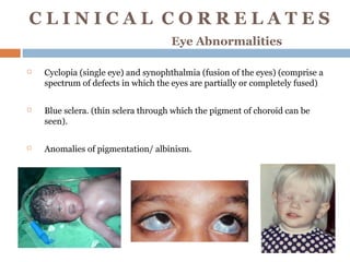 Embryology of the eye by Sumayya Naseem Optometrist | PPS