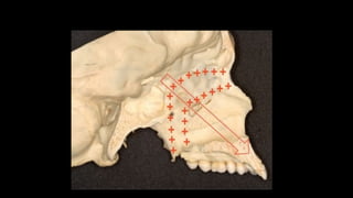 embryology (maxilla and mandibule development) .pdf