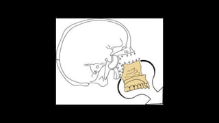 embryology (maxilla and mandibule development) .pdf