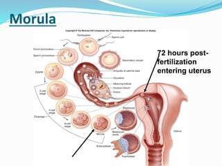 Morula
72 hours post-
fertilization
entering uterus
 