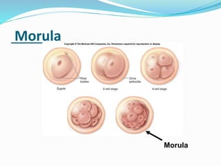 4. Blastocyst
 Morula, once entering the uterine cavity, floats
freely(next 2 days) and is covered by endometrial
fluid a...