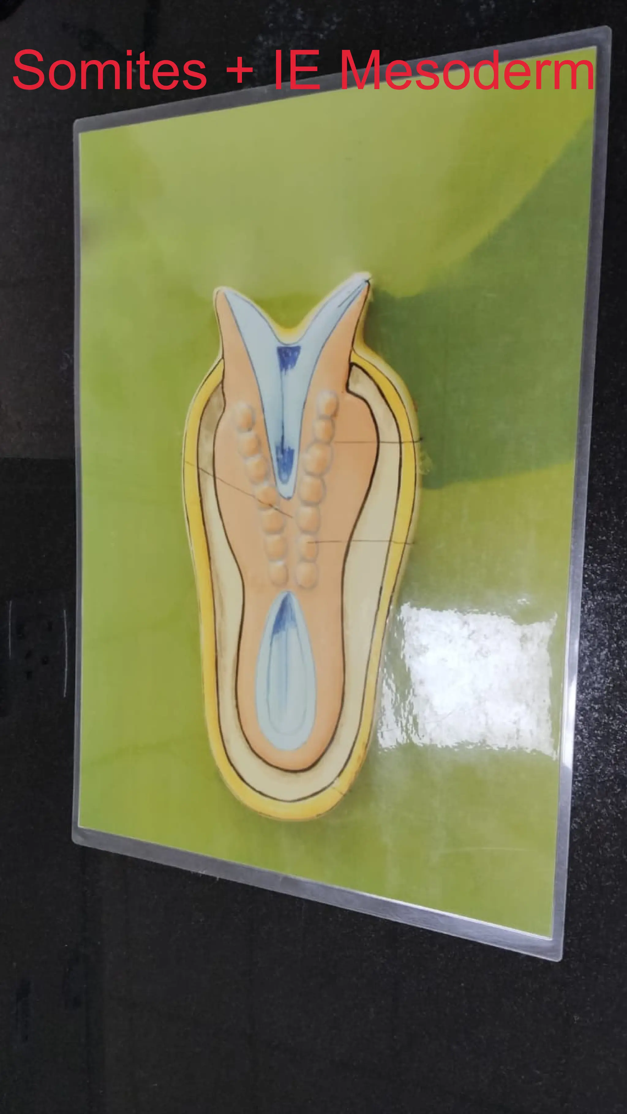 Somites + IE Mesoderm
 