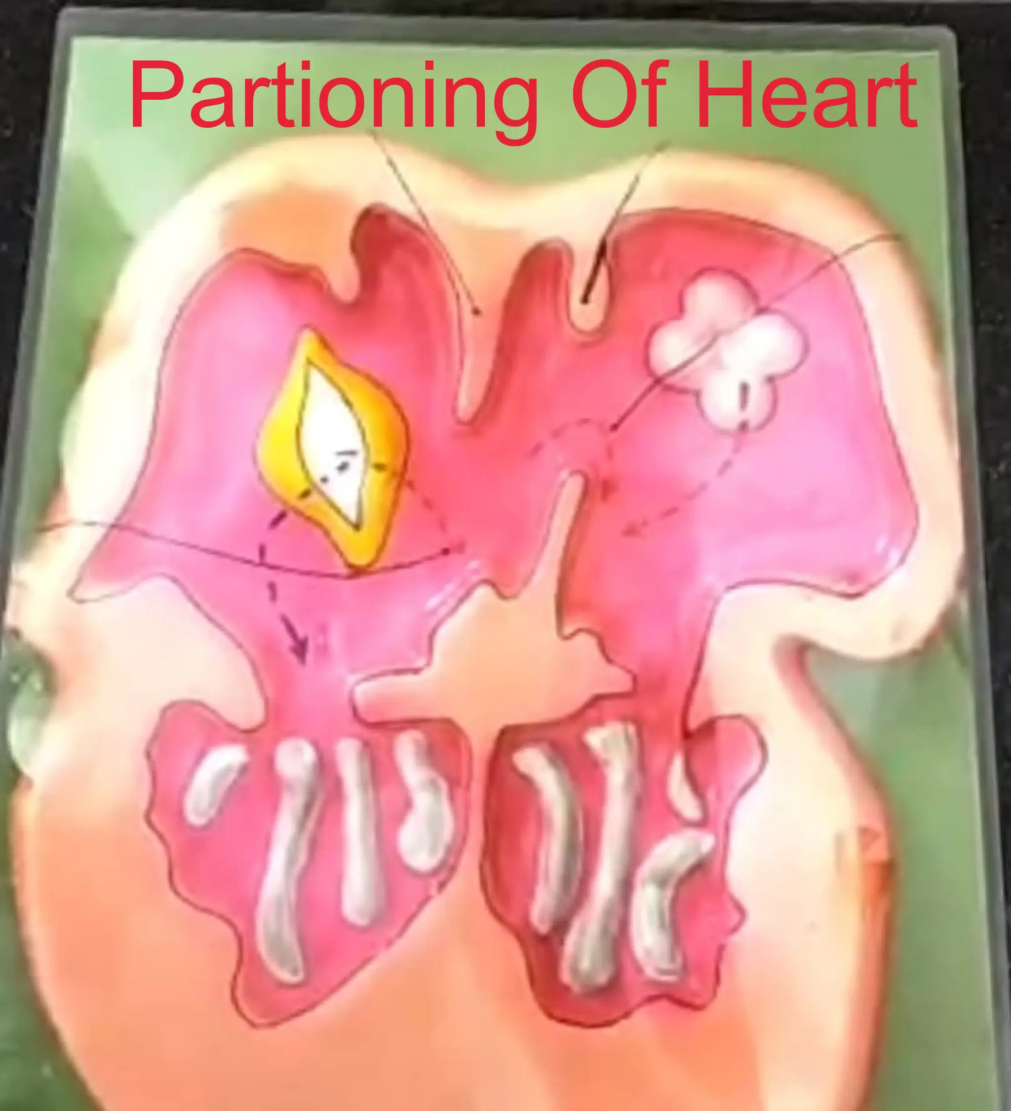 Partioning Of Heart
 