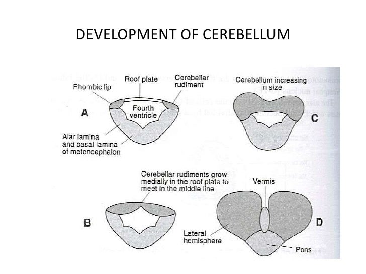 Image result for development of cerebellum