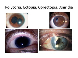 Embryology of eye | PPTX