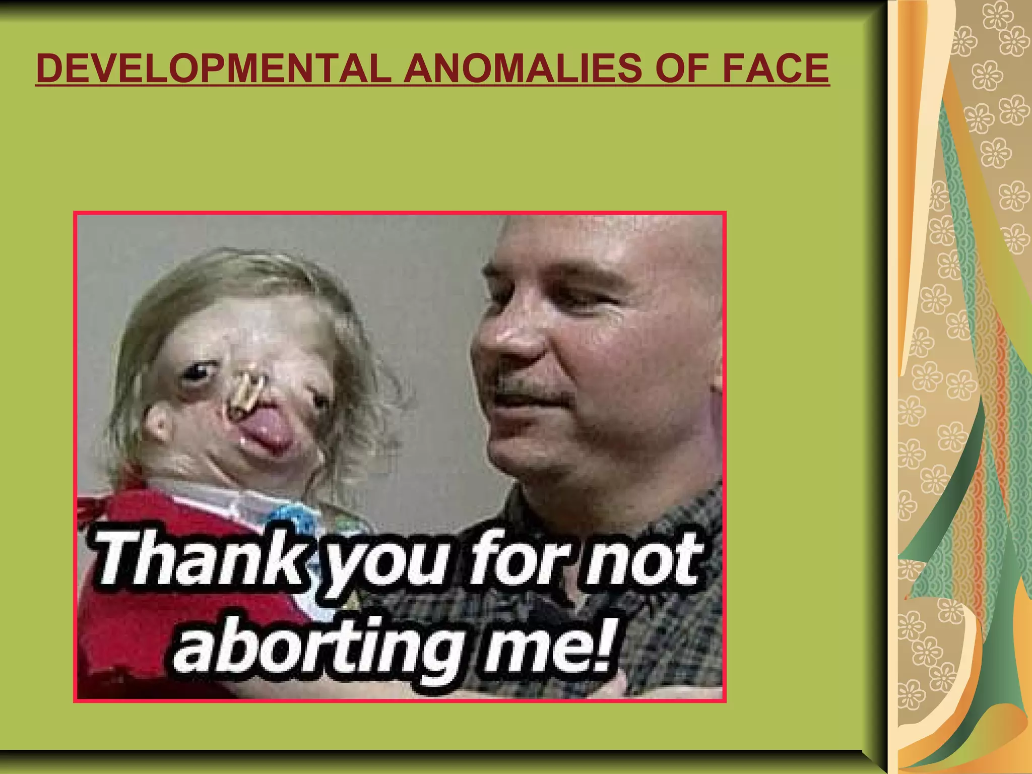 DEVELOPMENTAL ANOMALIES OF FACE
 