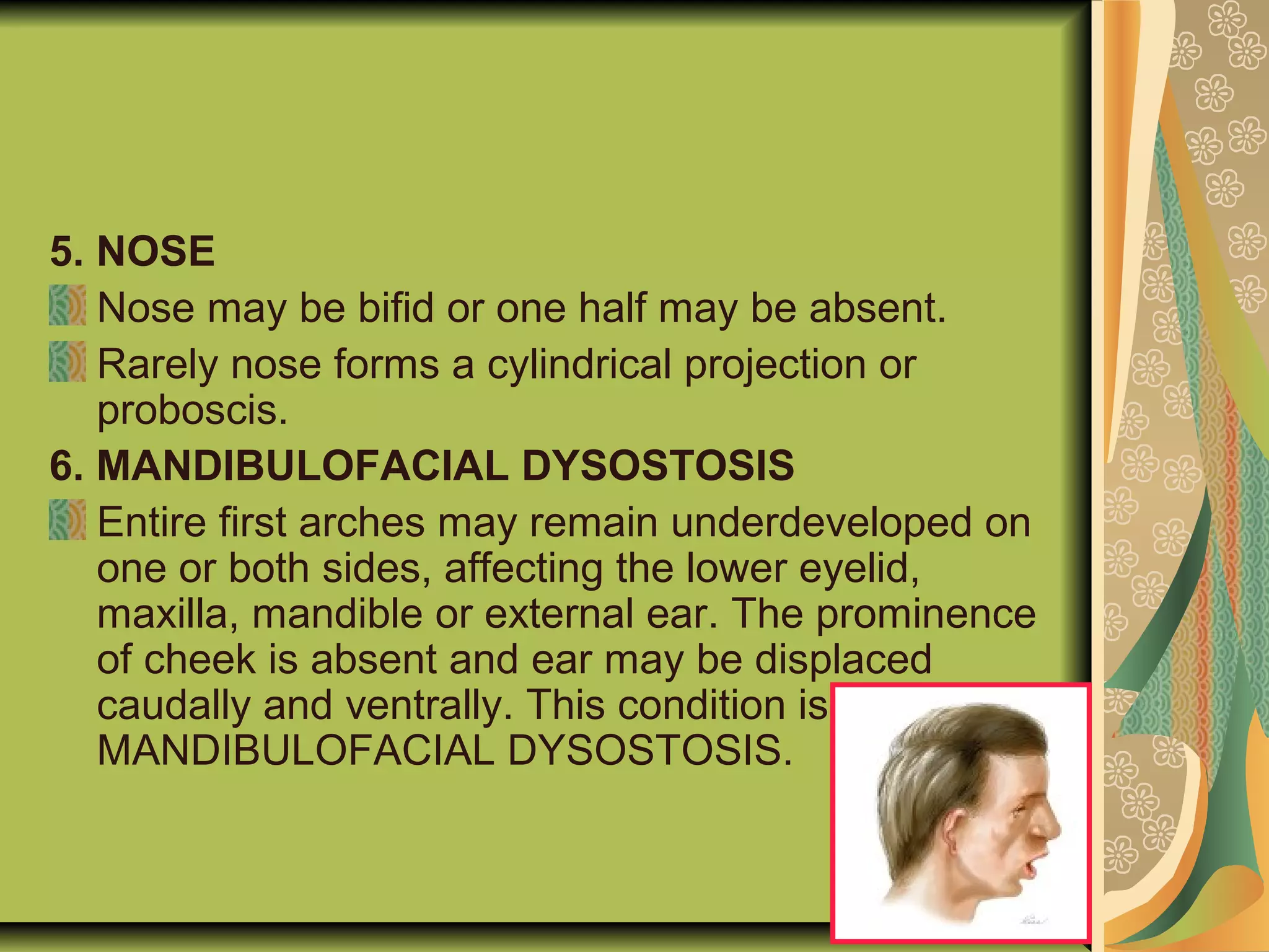 5. NOSE
Nose may be bifid or one half may be absent.
Rarely nose forms a cylindrical projection or
proboscis.
6. MANDIBULOFACIAL DYSOSTOSIS
Entire first arches may remain underdeveloped on
one or both sides, affecting the lower eyelid,
maxilla, mandible or external ear. The prominence
of cheek is absent and ear may be displaced
caudally and ventrally. This condition is
MANDIBULOFACIAL DYSOSTOSIS.
 