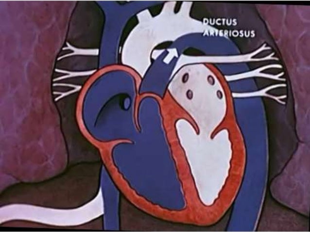 Embryology of heart and fetal circulation