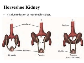 Embryology of kidney | PPTX