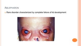 embryology of lids and adnexa.pptx embryology | PPTX
