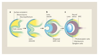 Comprehensive Embryology of the Human Eye: Developmental Stages and ...