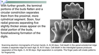 Embryo Hand Embryology of Upper, lower limbs and the.pptx