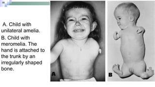 Embryology of Upper, lower limbs and the.pptx