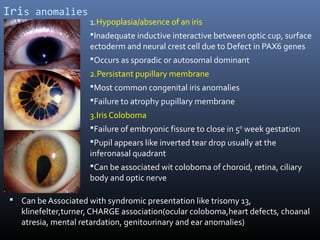 Defect In The Iris Embryology of human eye | PPT