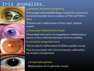 Polykorie Embryology of human eye | PPT
