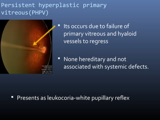 Pphpv Eye Embryology of human eye | PPT