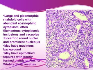 Embryonal brain tumours in children | PPT