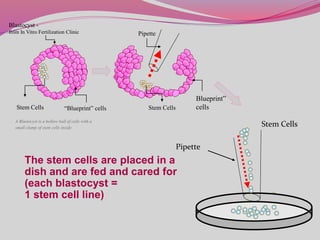 Blastocyst -
from In Vitro Fertilization Clinic
Stem Cells “Blueprint” cells
A Blastocyst is a hollow ball of cells with a
small clump of stem cells inside
Pipette
Stem Cells
Blueprint”
cells
Stem Cells
Pipette
The stem cells are placed in a
dish and are fed and cared for
(each blastocyst =
1 stem cell line)
 