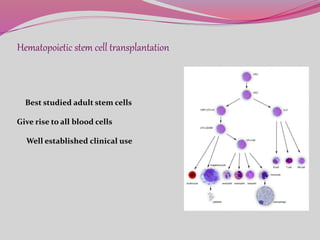 Hematopoietic stem cell transplantation
Best studied adult stem cells
Give rise to all blood cells
Well established clinical use
 