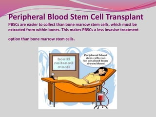 Peripheral Blood Stem Cell Transplant
PBSCs are easier to collect than bone marrow stem cells, which must be
extracted from within bones. This makes PBSCs a less invasive treatment
option than bone marrow stem cells.
 