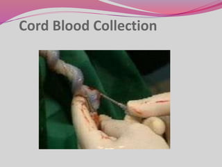 Cord Blood Collection
 