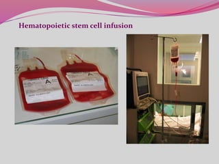 Hematopoietic stem cell infusion
 
