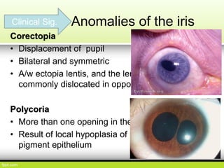 Polykorie Ocular Embryology | PDF