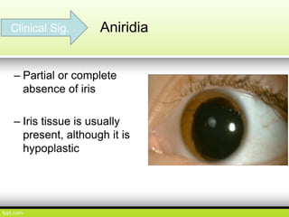 Ocular Embryology | PDF