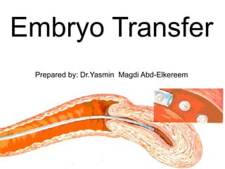 Embryo Transfer
Prepared by: Dr.Yasmin Magdi Abd-Elkereem
 