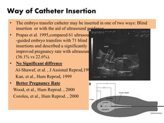 • The embryo transfer catheter may be inserted in one of two ways: Blind
insertion or with the aid of ultrasound guidance.
• Prapas et al. 1995,compared 61 ultrasound
-guided embryo transfers with 71 blind
insertions and described a significantly
improved pregnancy rate with ultrasound
(36.1% vs 22.6%).
• No Significant diffrence
Al-Shawaf, et al. , J Assisted Reprod,1993
Kan, et al., Hum Reprod, 1999
• Better Pregnancy Rate
Wood, et al., Hum Reprod. , 2000
Coroleu, et al., Hum Reprod. , 2000
Way of Catheter Insertion
 