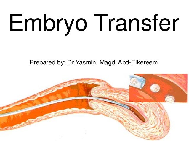 embryo transfer