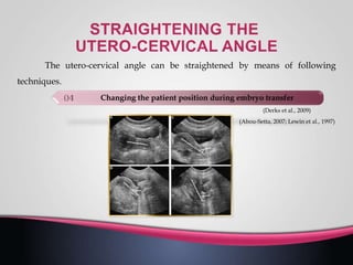 The utero-cervical angle can be straightened by means of following
techniques.
(Abou-Setta, 2007; Lewin et al., 1997)
Changing the patient position during embryo transfer
(Derks et al., 2009)
 