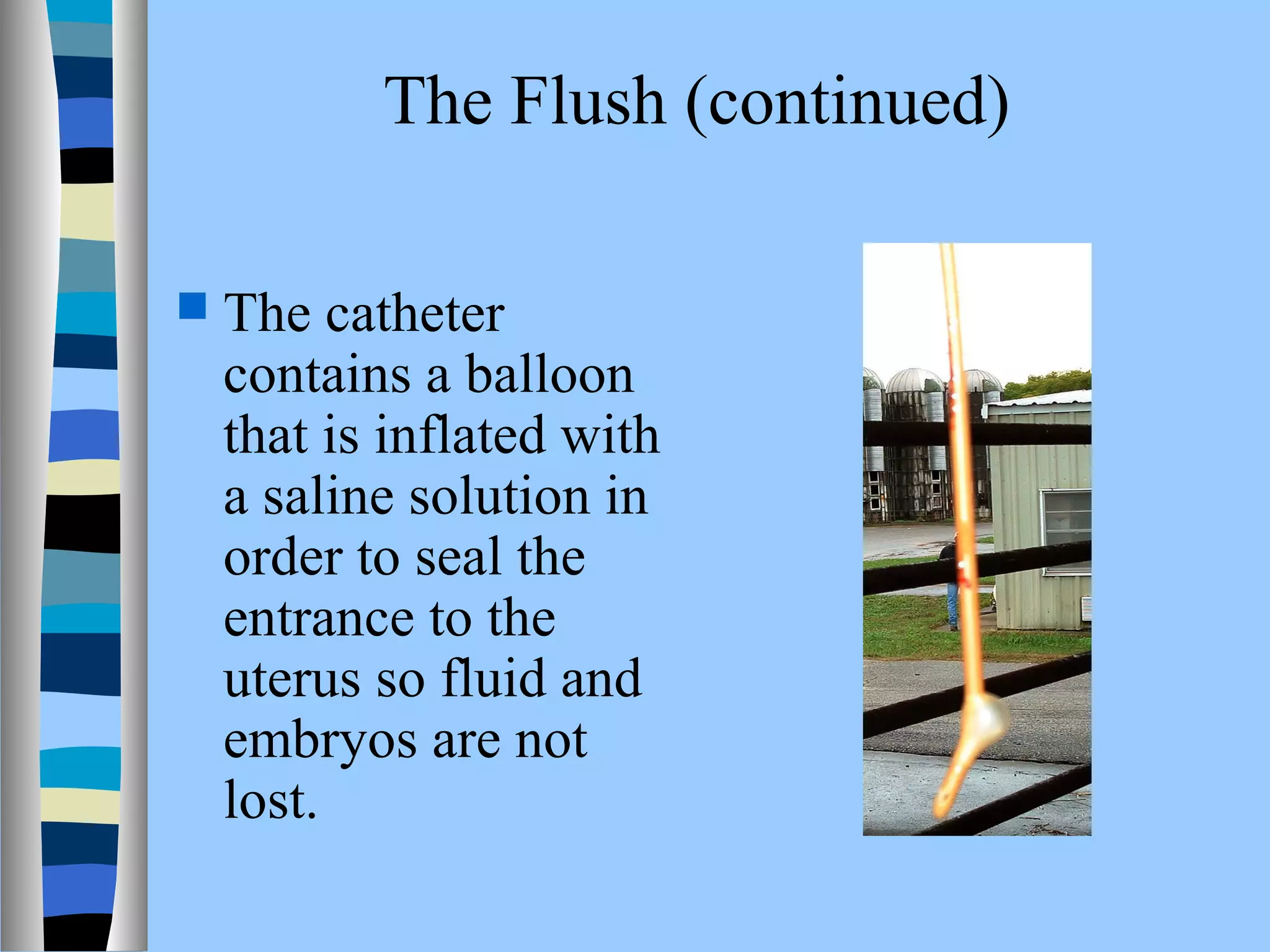 The Flush (continued) 
 The catheter 
contains a balloon 
that is inflated with 
a saline solution in 
order to seal the 
entrance to the 
uterus so fluid and 
embryos are not 
lost. 
 