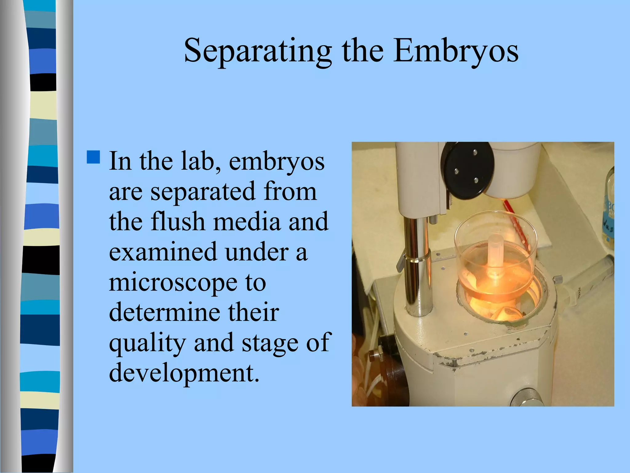 Separating the Embryos 
 In the lab, embryos 
are separated from 
the flush media and 
examined under a 
microscope to 
determine their 
quality and stage of 
development. 
 