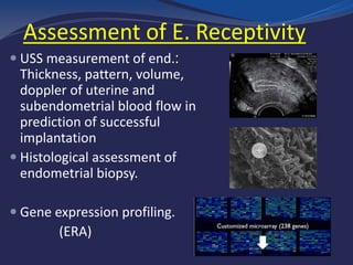 Assessment of E. Receptivity
 USS measurement of end.:
Thickness, pattern, volume,
doppler of uterine and
subendometrial blood flow in
prediction of successful
implantation
 Histological assessment of
endometrial biopsy.
 Gene expression profiling.
(ERA)
 