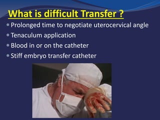 What is difficult Transfer ?
 Prolonged time to negotiate uterocervical angle
 Tenaculum application
 Blood in or on the catheter
 Stiff embryo transfer catheter
 