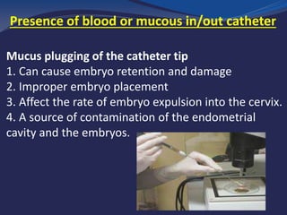 Mucus plugging of the catheter tip
1. Can cause embryo retention and damage
2. Improper embryo placement
3. Affect the rate of embryo expulsion into the cervix.
4. A source of contamination of the endometrial
cavity and the embryos.
Presence of blood or mucous in/out catheter
 