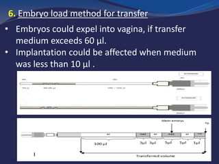 6. Embryo load method for transfer
• Embryos could expel into vagina, if transfer
medium exceeds 60 μl.
• Implantation could be affected when medium
was less than 10 μl .
 