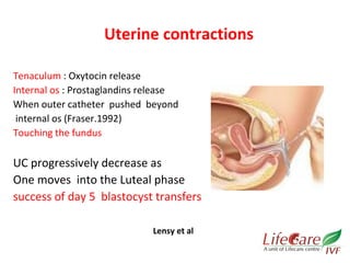 Uterine contractions 
Tenaculum : Oxytocin release 
Internal os : Prostaglandins release 
When outer catheter pushed beyond 
internal os (Fraser.1992) 
Touching the fundus 
UC progressively decrease as 
One moves into the Luteal phase 
success of day 5 blastocyst transfers 
Lensy et al 
 